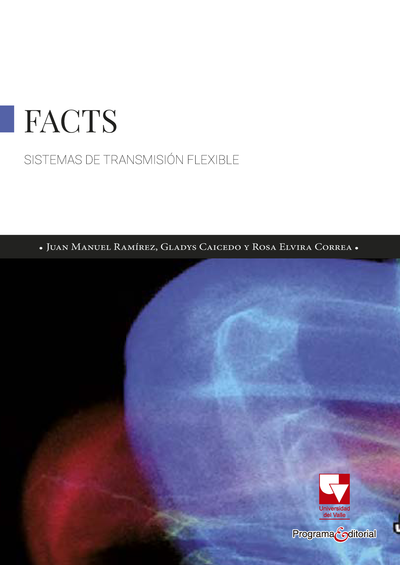 Sistemas de transmisión flexibles FACTS
