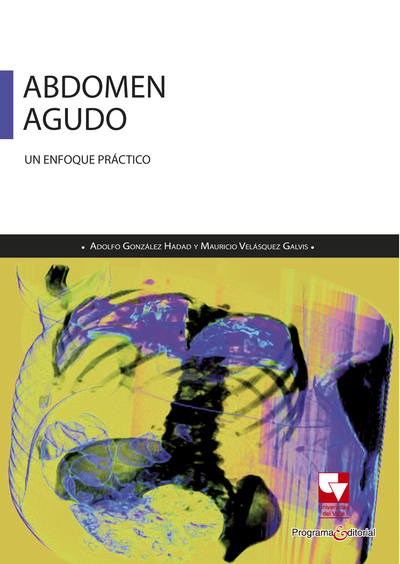 Abdomen agudo: un enfoque práctico