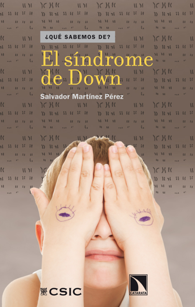 El síndrome de Down