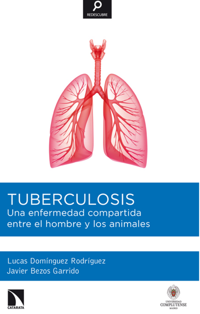 Tuberculosis: una enfermedad compartida entre el hombre y los animales