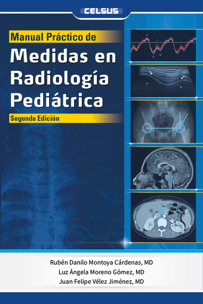 Manual practico de medidas en radiología pediátrica (2a. ed.)