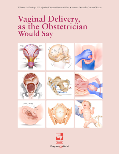 Vaginal Delivery, as the Obstetrician Would Say