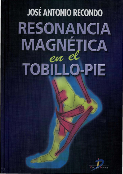 Resonancia magnética en el tobillo-pie