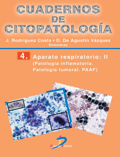 Cuadernos de citopatología 4: aparato respiratorio II: patología inflamatoria. Patología tumoral. PAAF