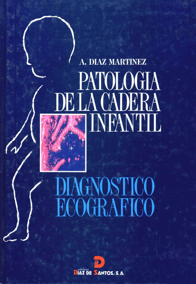 Patología de la cadera infantil: diagnóstico ecográfico