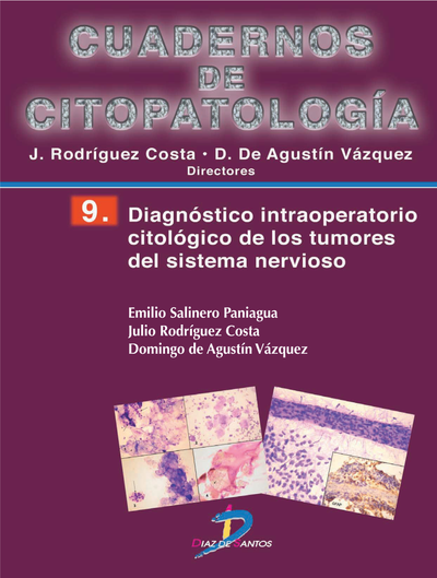 Diagnóstico intraoperatorio citológico de los tumores del sistema nervioso