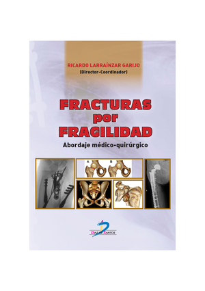 Fracturas por fragilidad: abordaje médico-quirúrgico