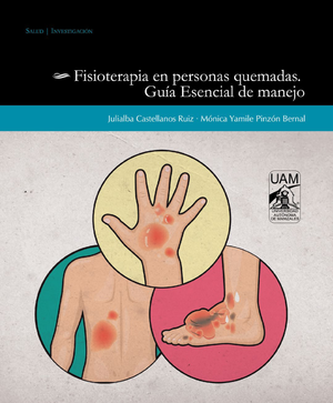 Fisioterapia en personas quemadas: guía esencial de manejo