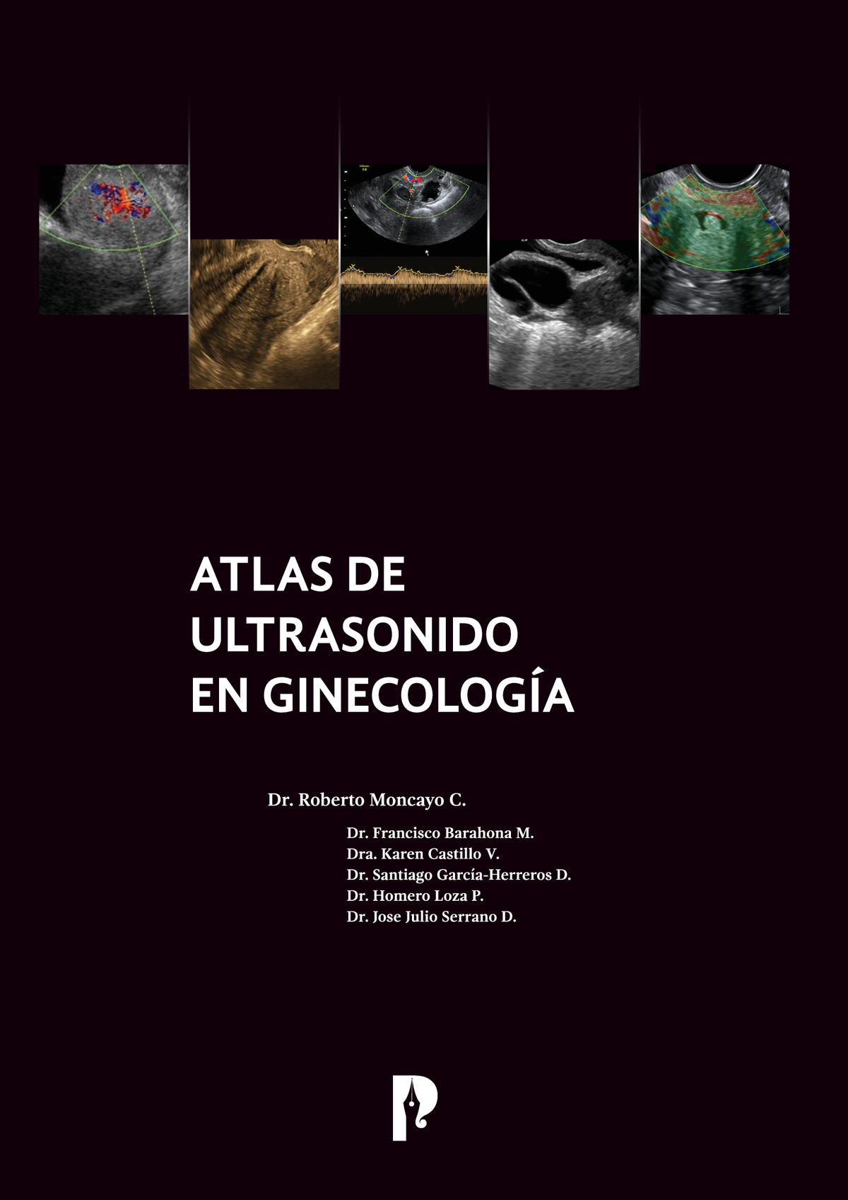 Atlas de ultrasonido en ginecología