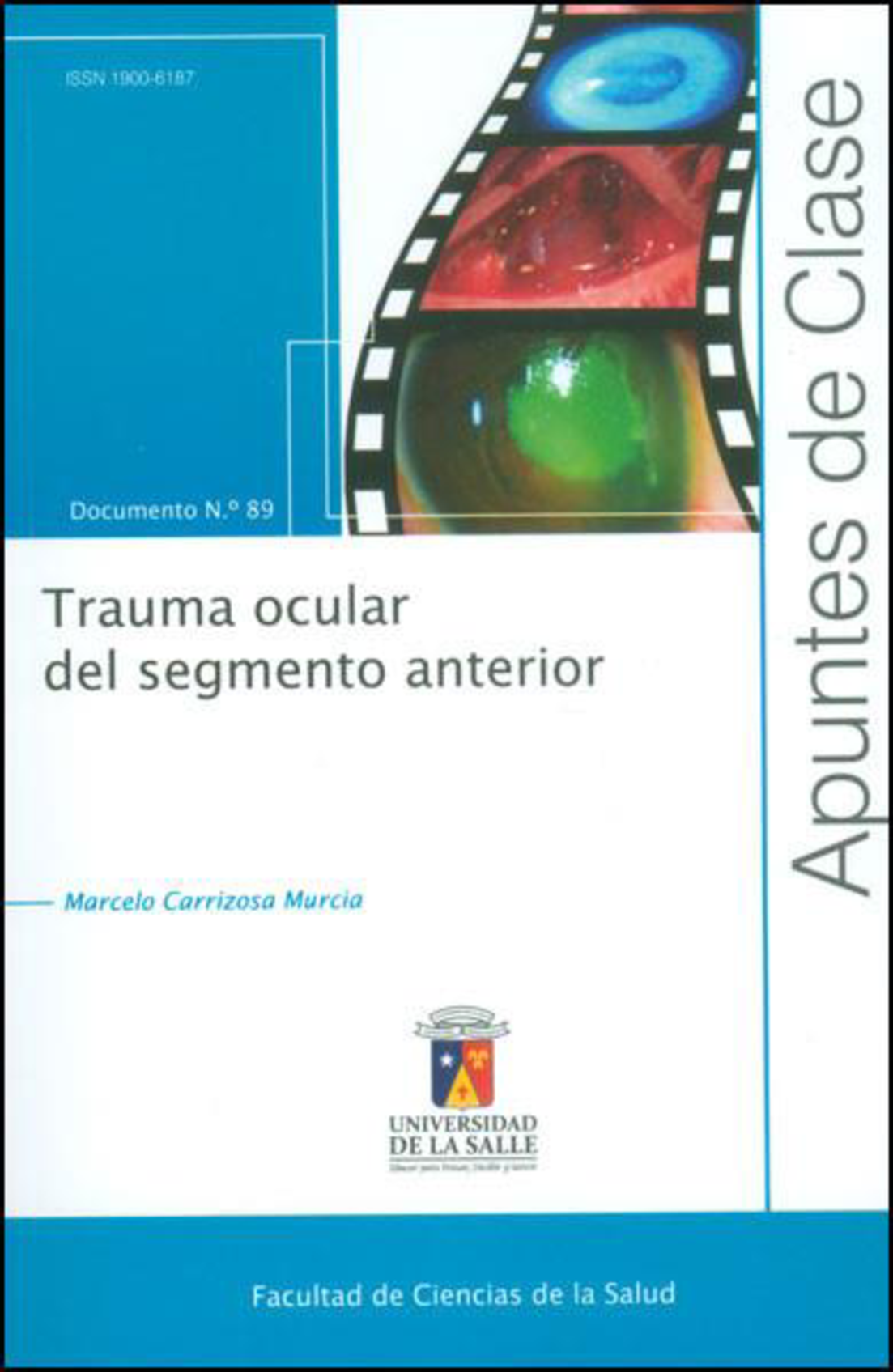 Trauma ocular del segmento anterior: Evaluación y manejo en cuidado primario ocular