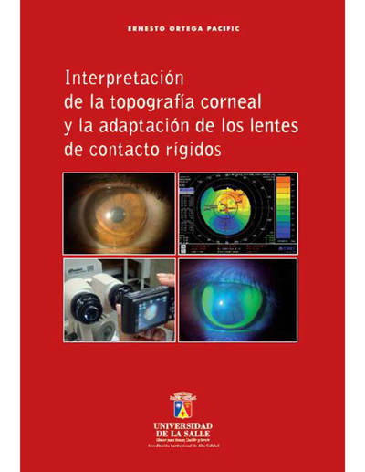 Interpretación de la topografía corneal y la adaptación de los lentes de contacto rígidos