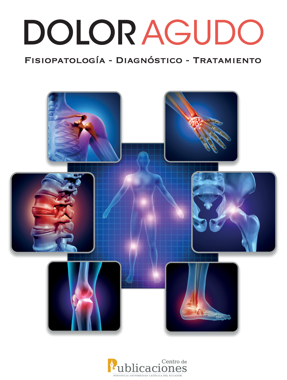 Dolor agudo: fisiopatología-diagnóstico-tratamiento