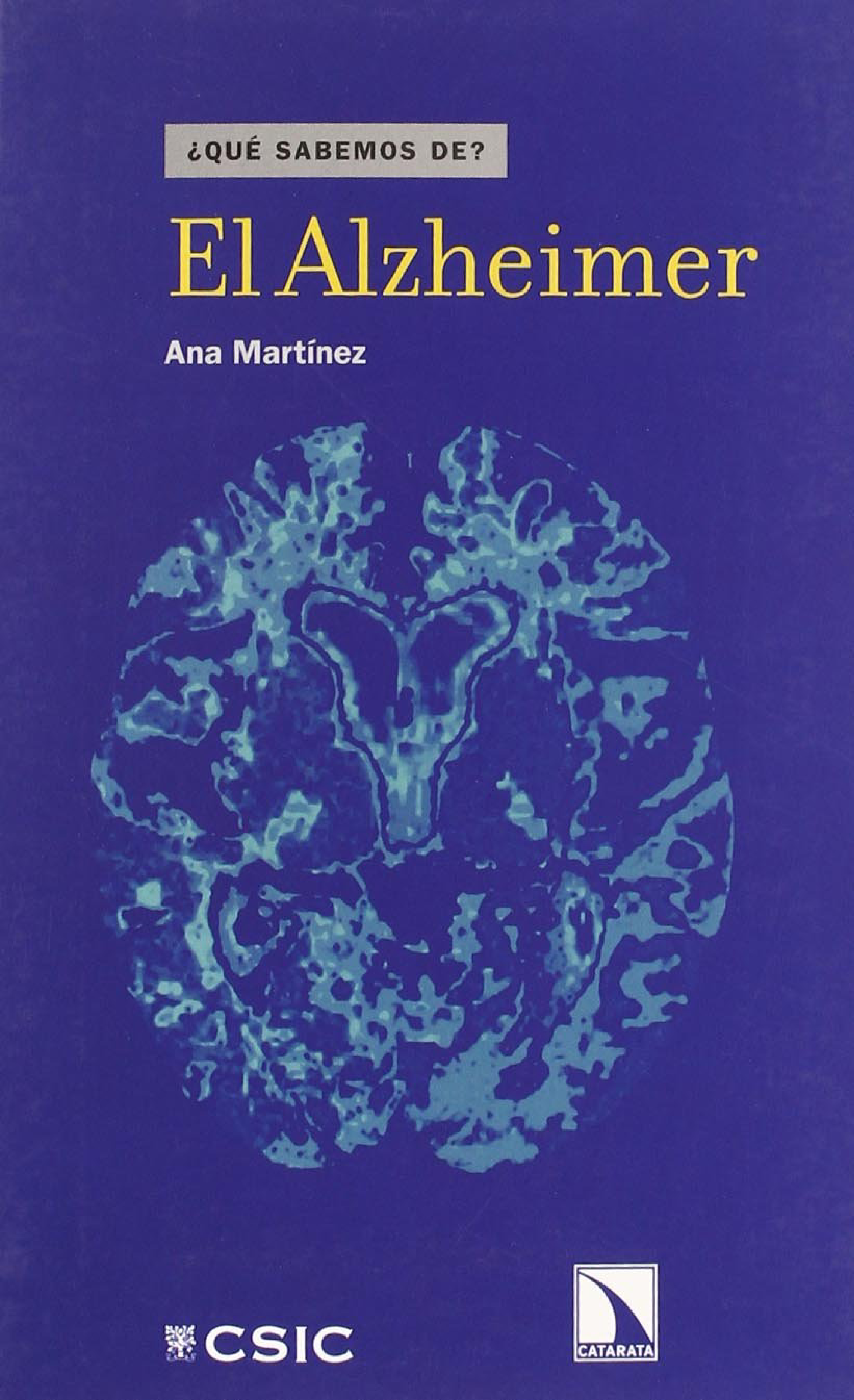 El Alzheimer