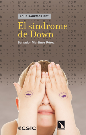 El síndrome de Down