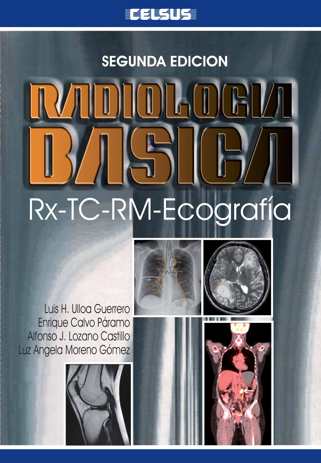 Radiología básica ( 2a. ed.)
