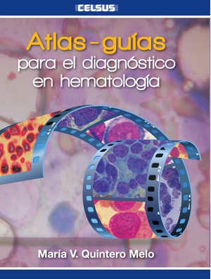 Atlas-guías para el diagnóstico en hematología