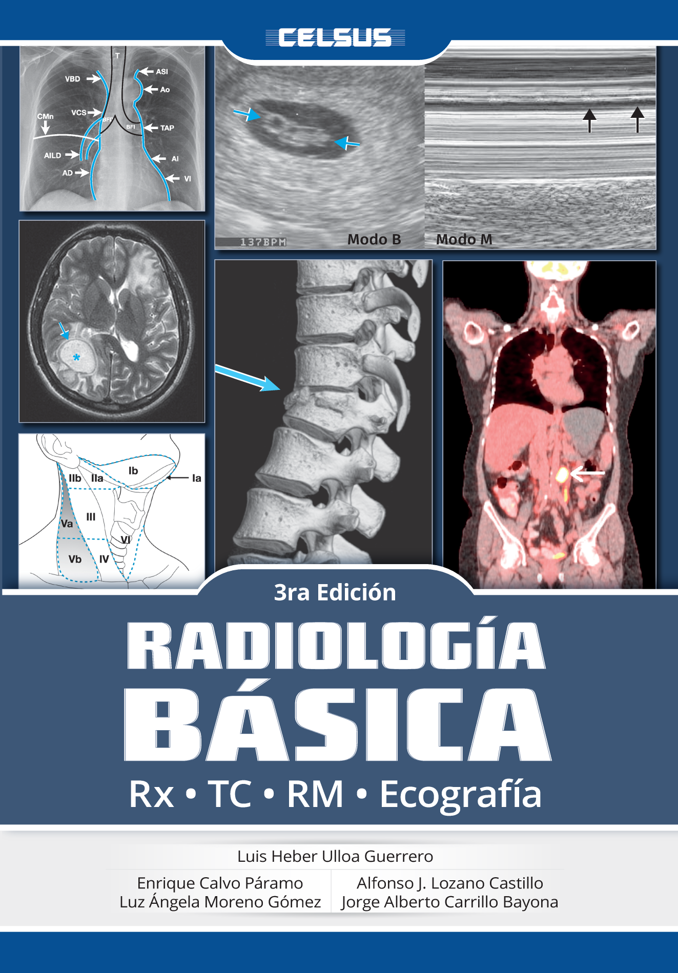 Radiología básica (3a. ed.)