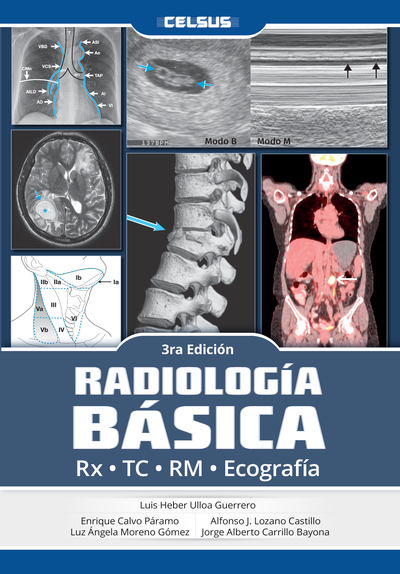 Radiología básica (3a. ed.)