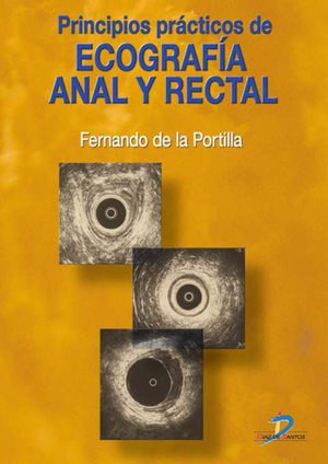 Principios prácticos de ecografía anal y rectal