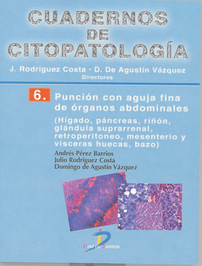 Cuadernos de citopatología 6: punción con aguja fina de órganos abdominales (Hígado, páncreas, riñón, glándula suprarrenal, retroperitoneo, mesenterio y vísceras huecas, bazo)