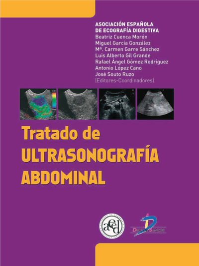 Tratado de ultrasonografía abdominal