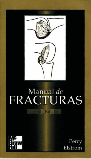 Manual de fracturas