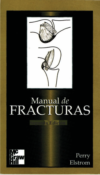 Manual de fracturas