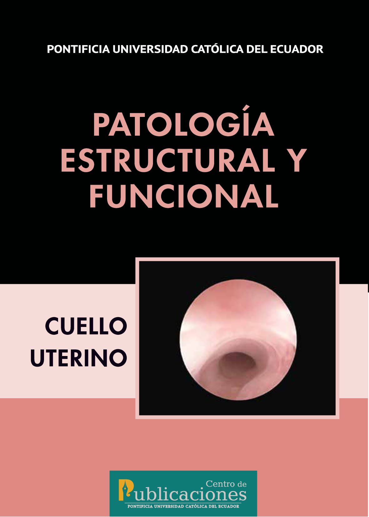 Patología estructural y funcional: cuello uterino