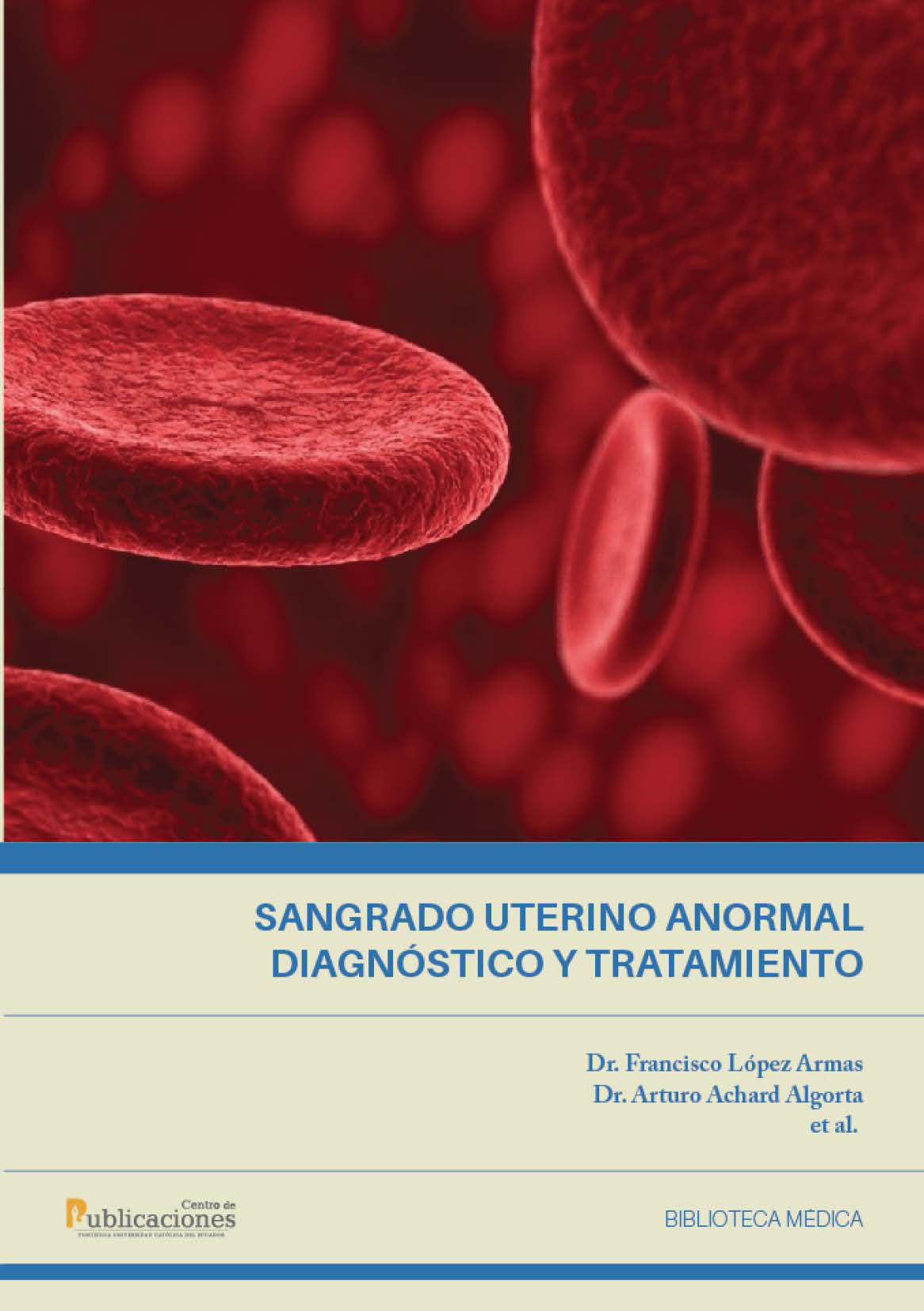 Sangrado uterino anormal: diagnóstico y tratamiento