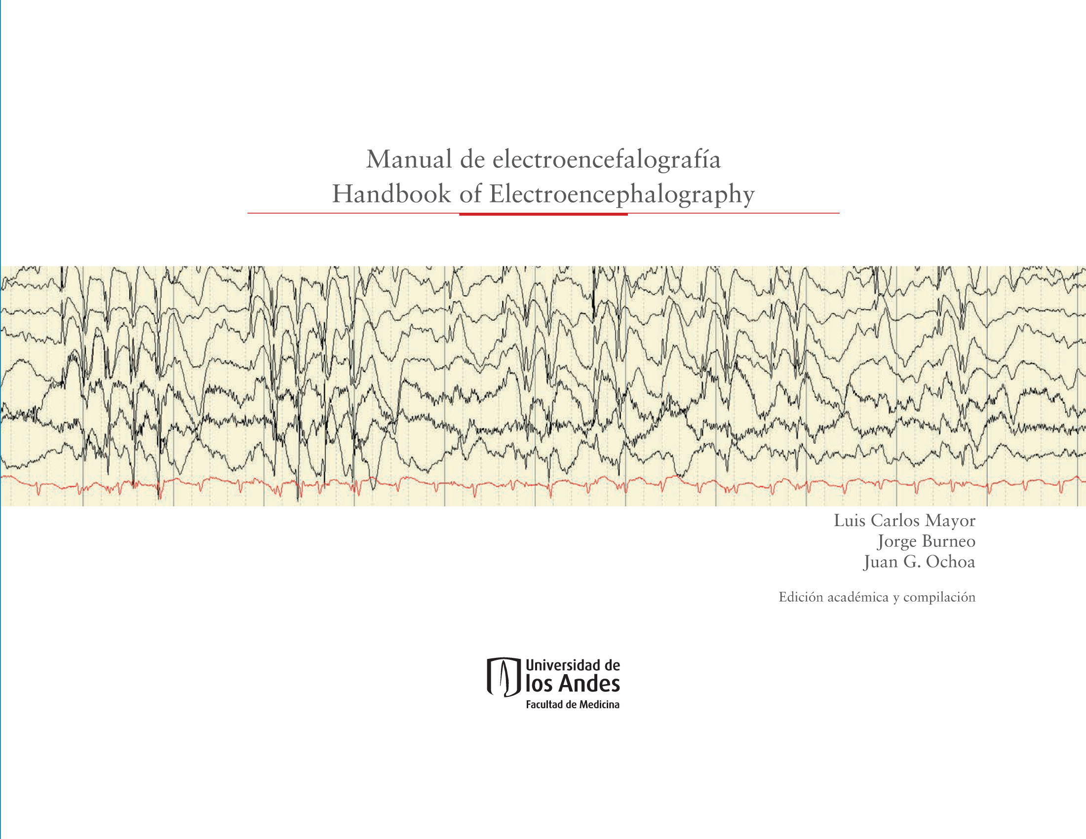 Manual de electroencefalografía