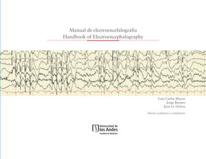 Manual de electroencefalografía