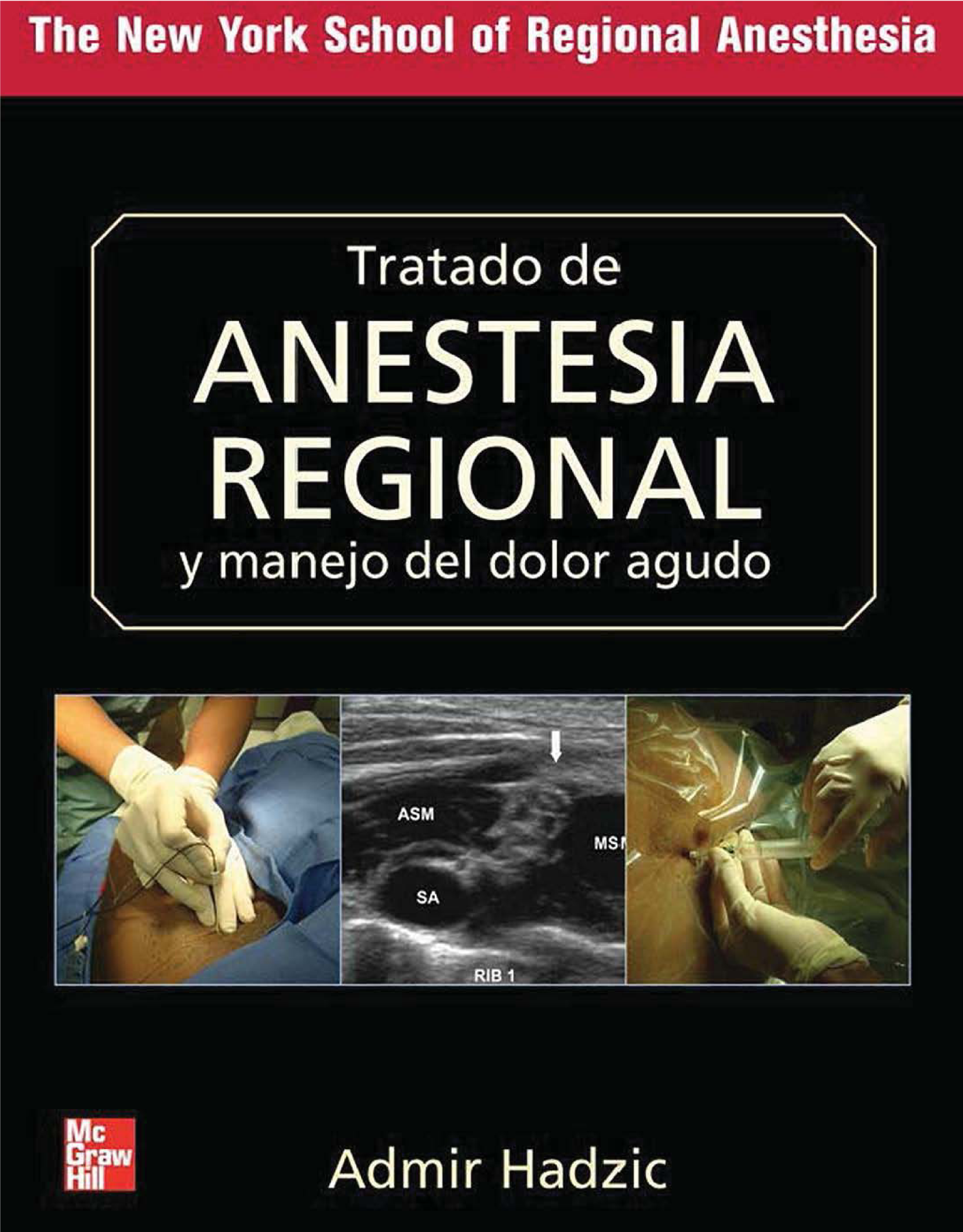 Tratado de anestesia regional y manejo del dolor agudo